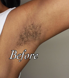 No-shave Body Hair Removal Cream