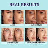 All-In-One Moisturizer, Concealer & Coverage