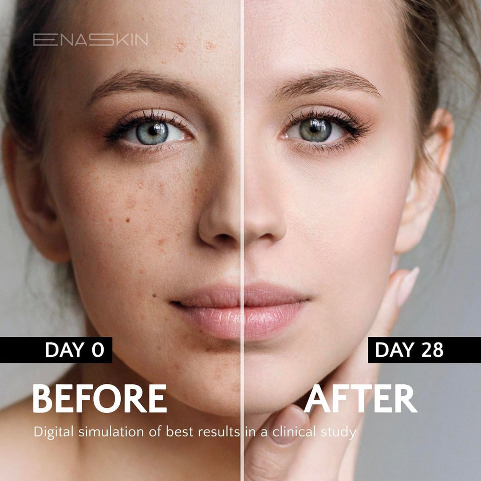 Dark Spots Remover