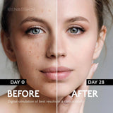 Dark Spots Remover