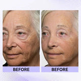 Instant Eye Tightener Easy-Wear Technology